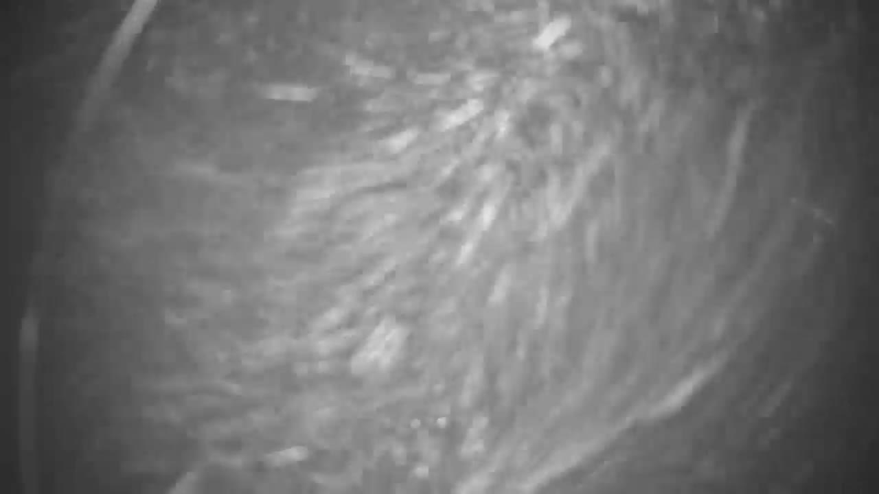 Jahodna Ski Slope East View Live Cam - Sever, Kosice 1, Kosice, Slovakia