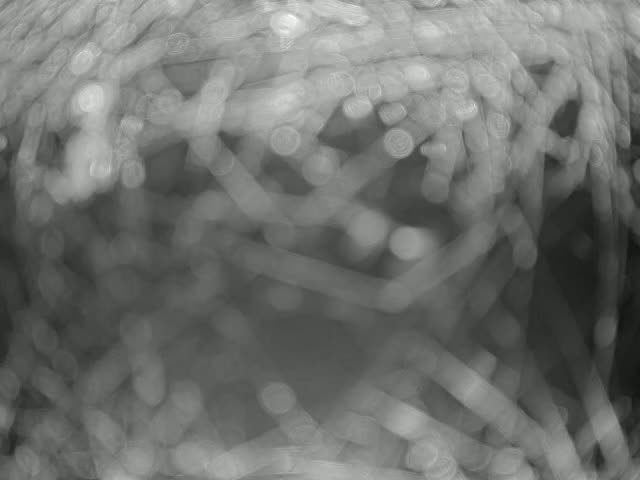 A blurry grayscale image shows a dense mass of thin, intertwined strands.