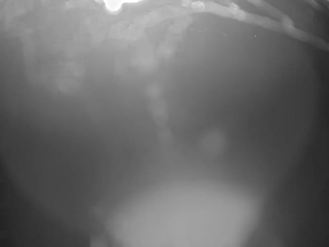 A blurry, monochromatic image depicts an extremely dark and hazy outdoor scene at night, featuring indistinct tree branches or wires across the top and diffuse light at the bottom.