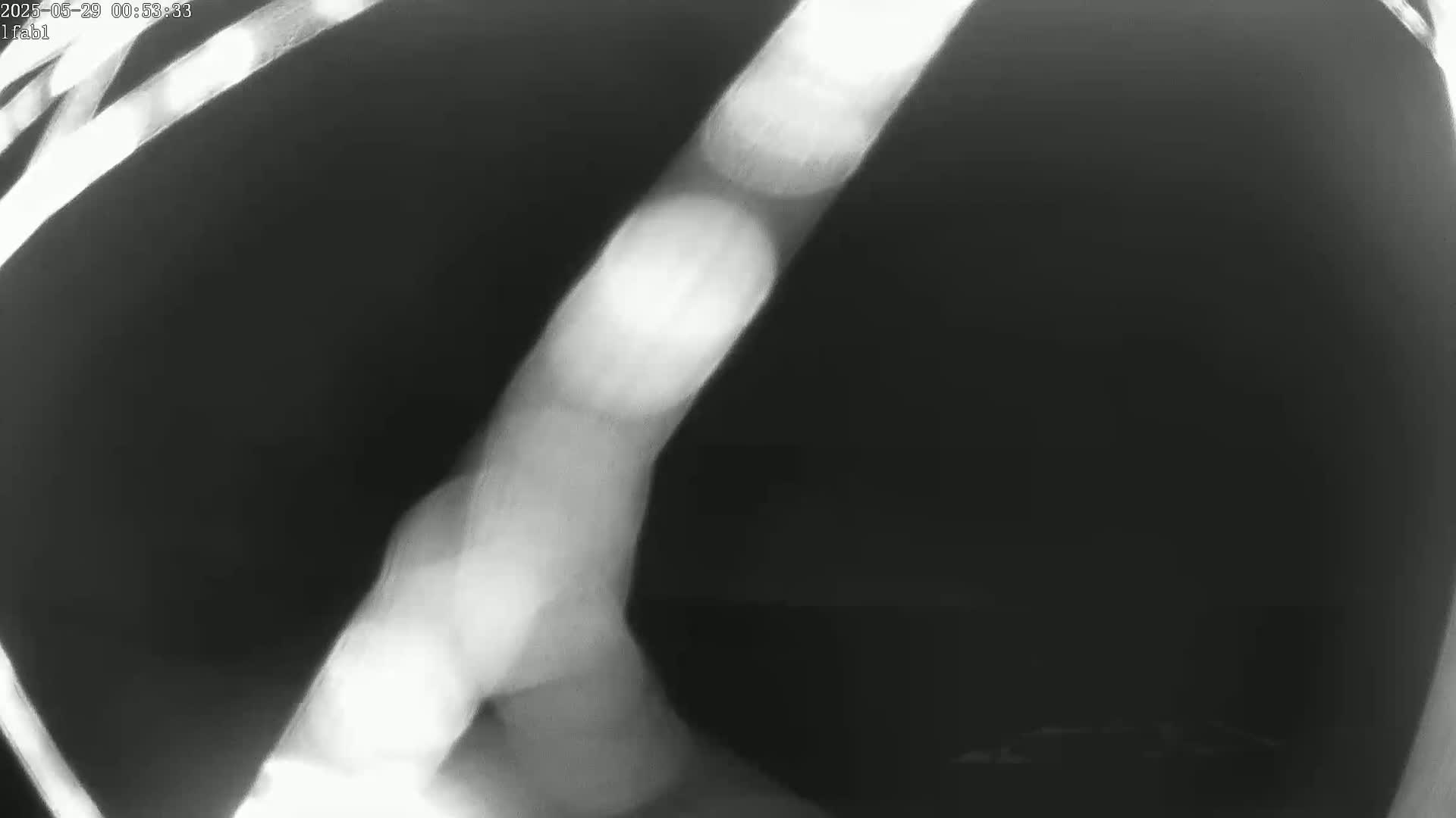 A grainy, black-and-white image shows a blurry, curved shape with brighter, round areas along its length.