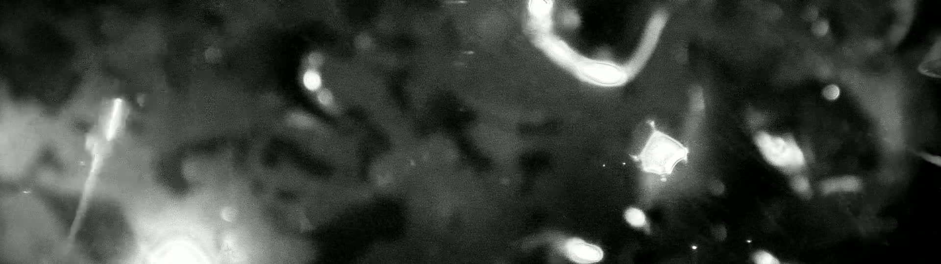 A blurry, monochromatic image shows indistinct shapes and bright spots of light against a dark background.