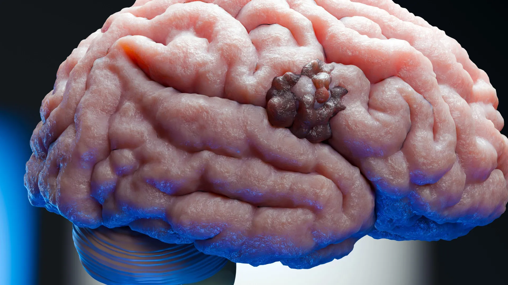 70-Year-Old Pregnancy Drug Uncovers Hidden Brain Cancer Vulnerability at University of Pennsylvania