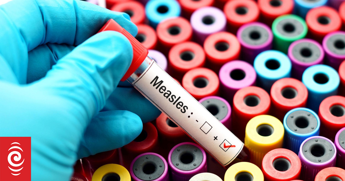 New Zealand Faces Undetected Measles Spread: Paediatrician Warns of Community Transmission & Low Vaccination Risk