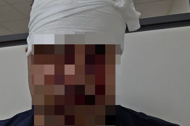 Indian Cab Driver Attacked in Dublin: Xenophobic Assault Raises Safety Concerns in Ireland