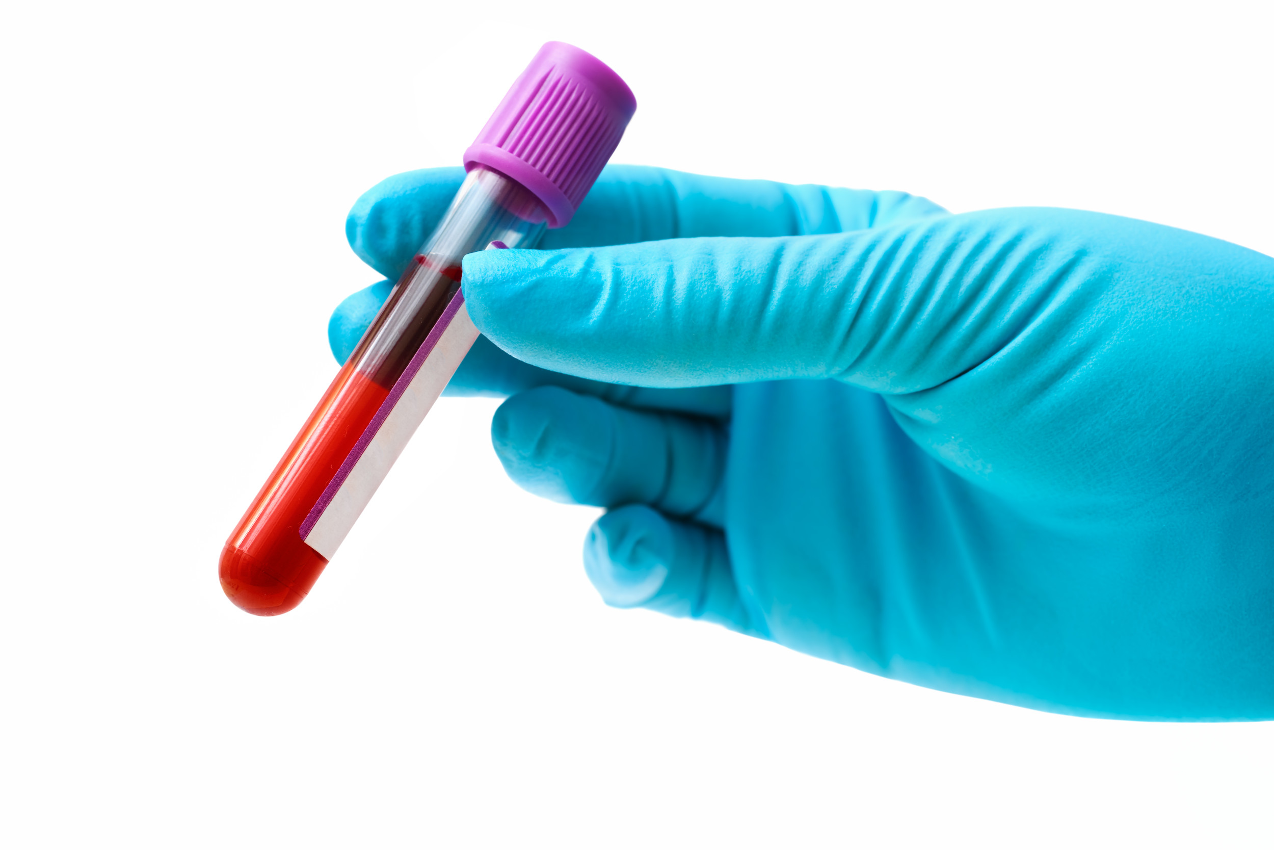 Universal Artificial Blood: Clinical Trials Offer Hope for All Blood Types