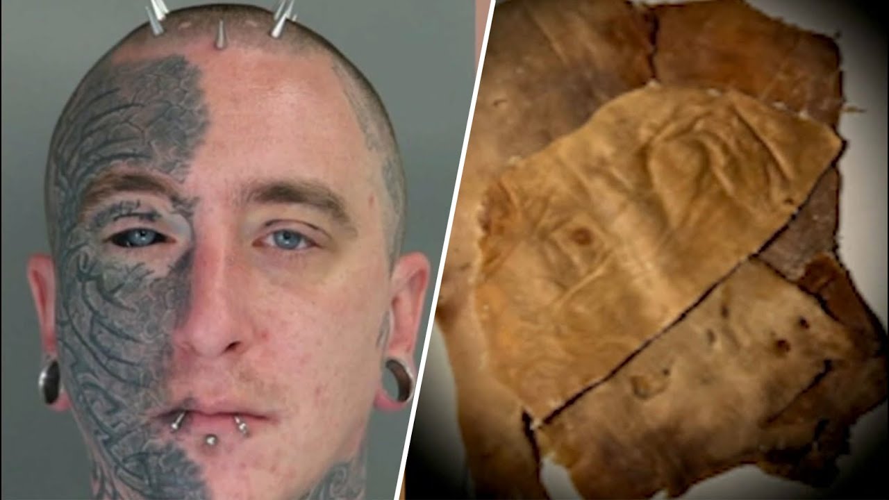 Ex-Harvard Employee Accused of Stealing and Selling Human Remains on Black Market