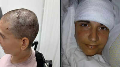 Audrey Crews: Paralyzed Woman Writes Name After 20 Years Using Neuralink Brain Chip