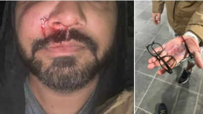 Indian AI Scientist Santosh Yadav Attacked in Dublin; Calls for Action Against Rising Racism