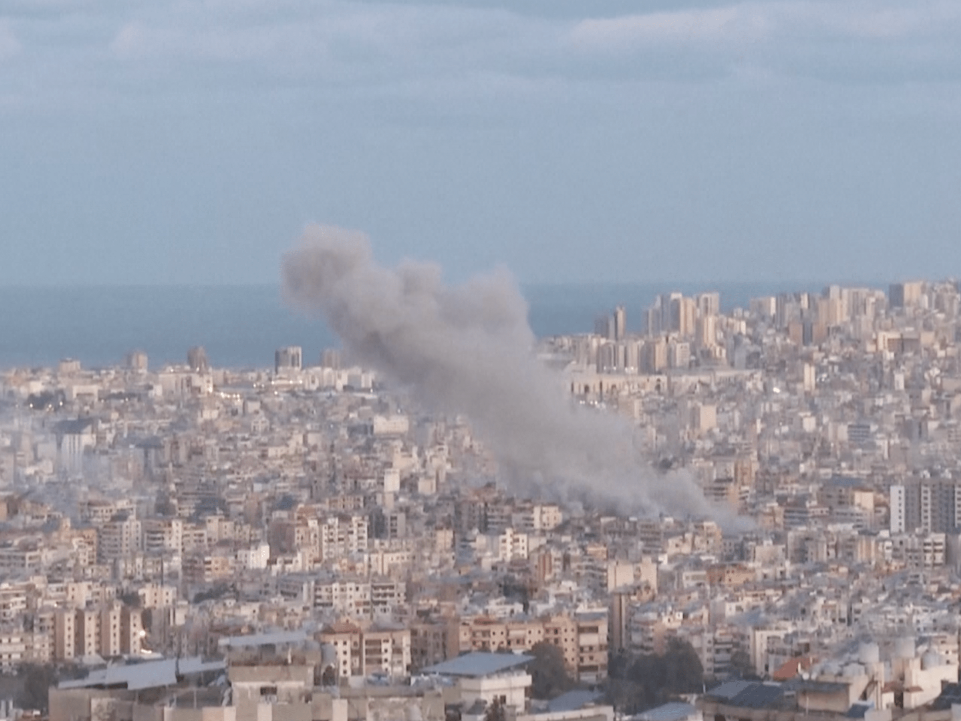 Children Wounded in US-Israeli Strikes Receive Treatment in Tehran