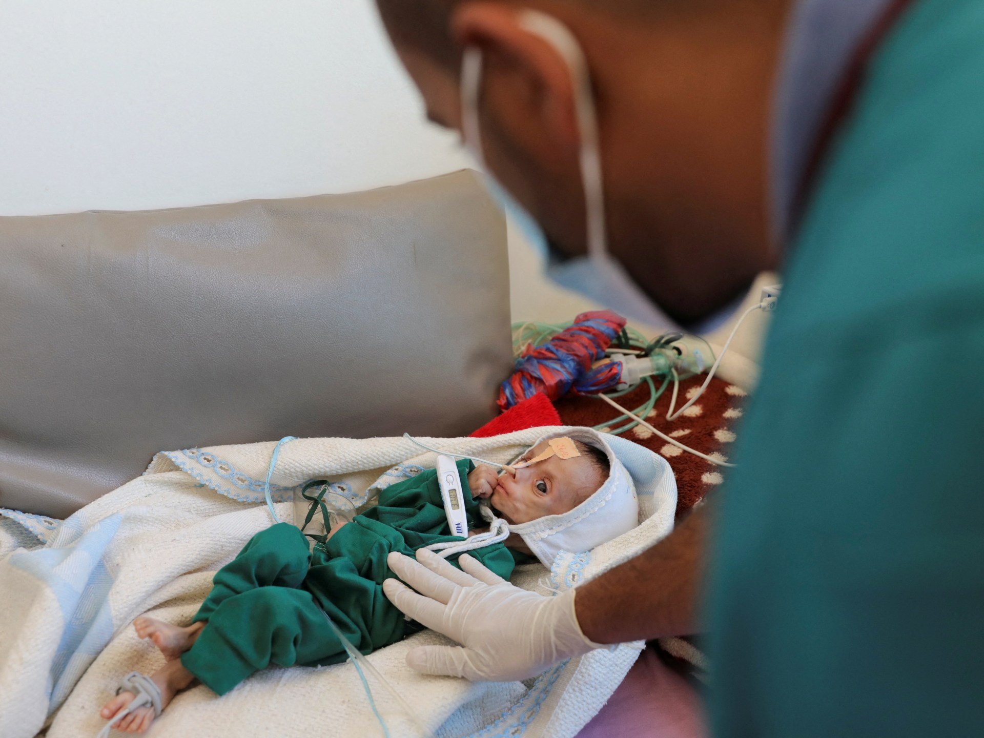 Yemen Faces Severe Food Insecurity