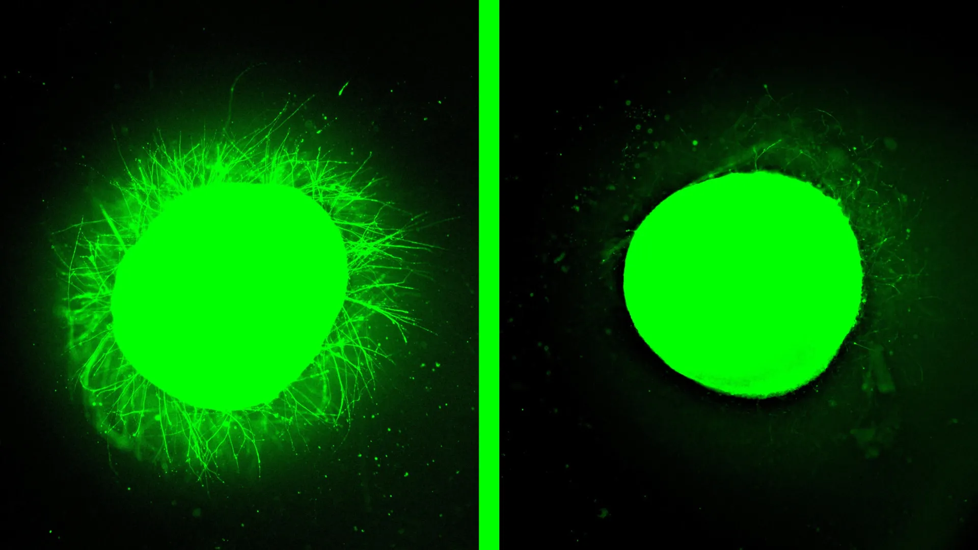 Lab-grown human spinal cord heals injury in breakthrough